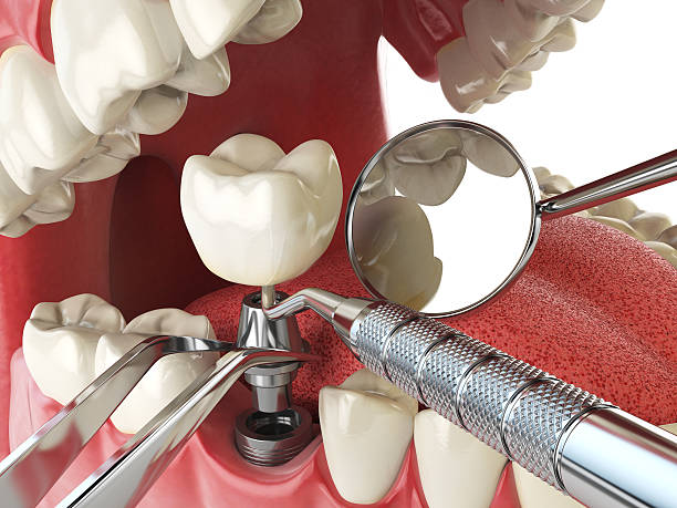 Reliable TX Emergency Dental Service Solutions