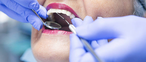 Best Emergency Wisdom Tooth Extraction in Fort Clark Springs, TX